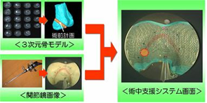 Perioperative navigation system for arthroscopic surgery.